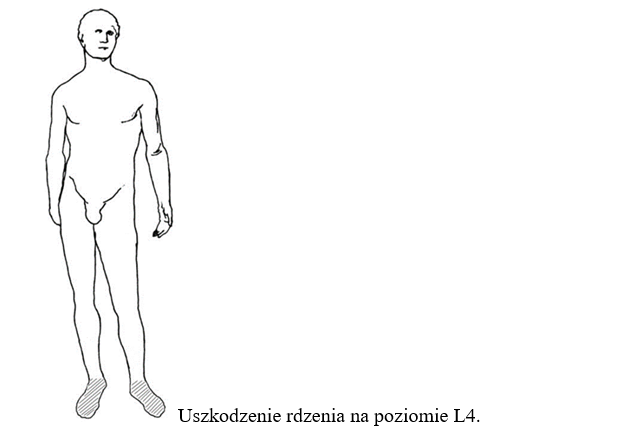 kto może wypisać pieluchomajtki ile na nfz miesięcznie lublin